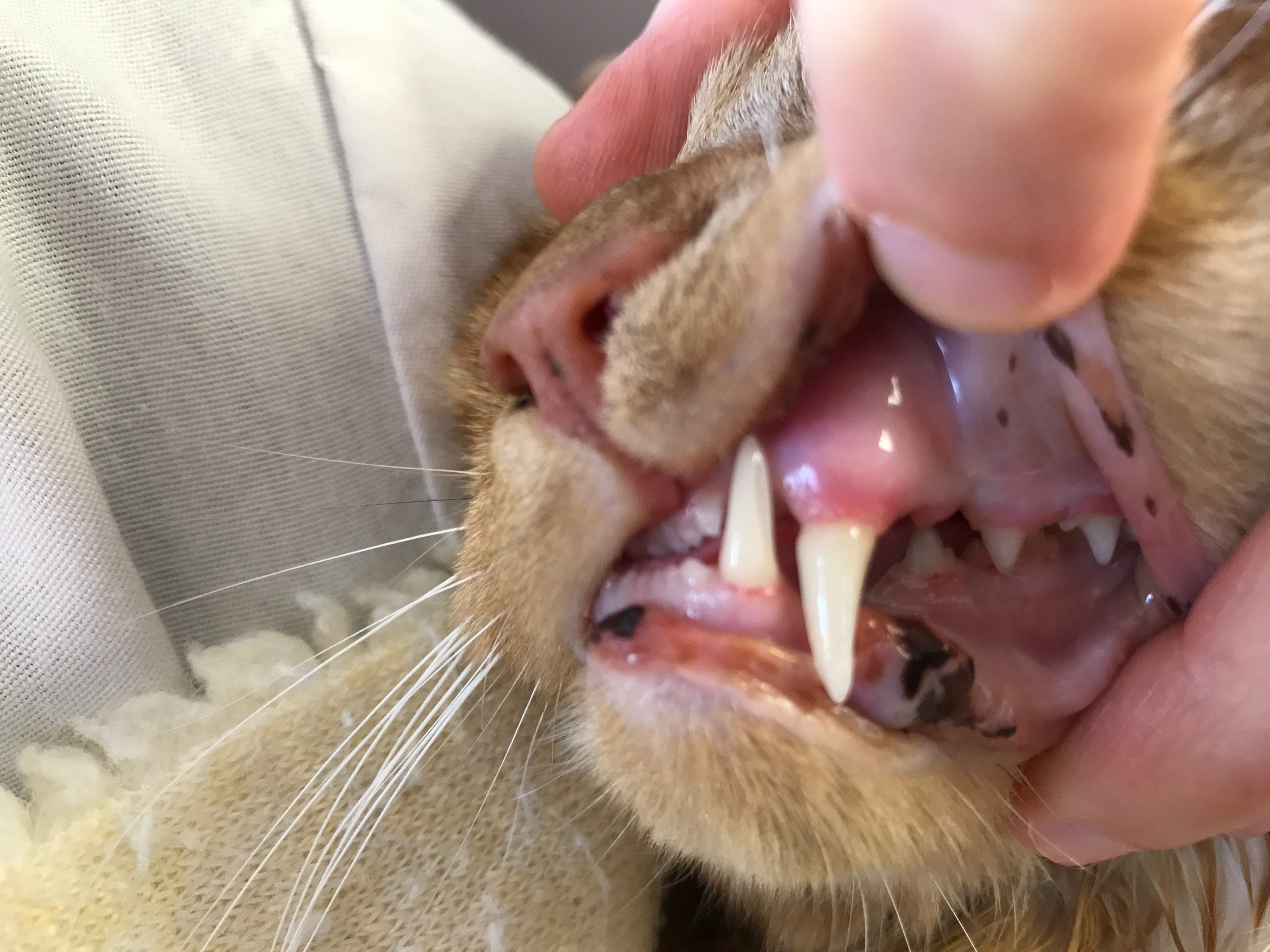 Professional dental cleaning